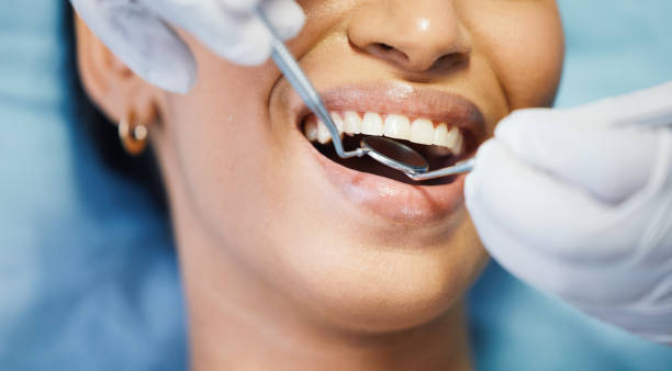 Best Emergency Root Canal Treatment in Independence, WI