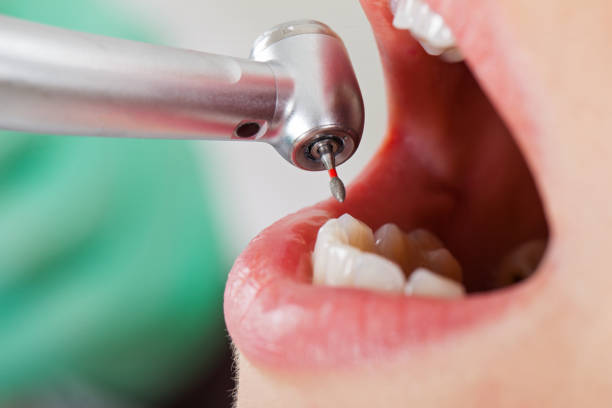 Best Emergency Treatment for Toothache in Independence, WI